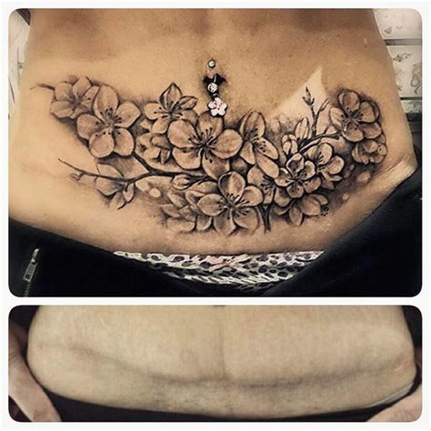 tummy tuck tattoo cover up|tummy tuck scar tattoos pictures.